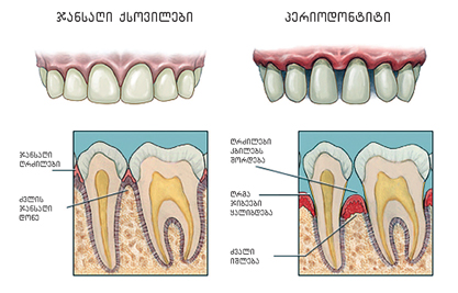 პაროდონტოლოგია